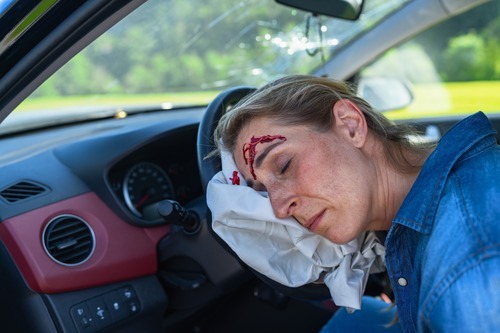 Woman Suffering Airbag Injury