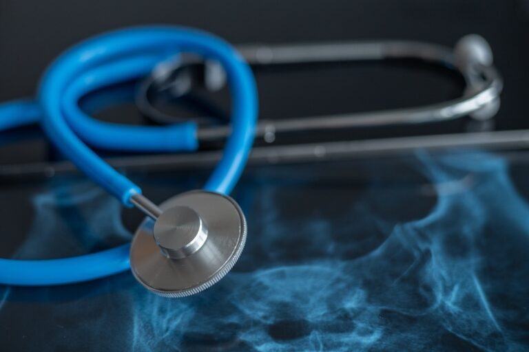 A car accident doctor's stethoscope is resting on a table.